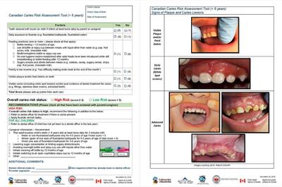 A mixed methods approach to obtaining health care provider feedback for the development of a Canadian pediatric dental caries risk assessment tool for children <6 years